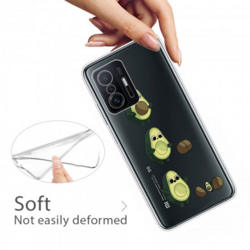 Cover Xiaomi 11T / 11T Pro En Advokats Liv